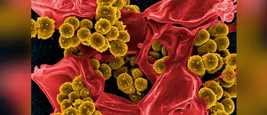 Esta es la bacteria responsable de la muerte de dos niños en Argentina. (Foto: Pixabay) Streptococcus pyogene, la bacteria que afecta mayormente a los niños