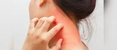 ¿Cómo hacer que pase la alergia a la penicilina? ¿Cómo hacer que pase la alergia a la penicilina?