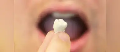 ¿Qué significa soñar que se te caen los dientes? ¿Qué significa soñar que se te caen los dientes?