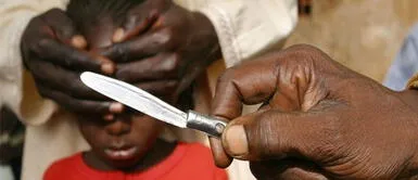 Esta práctica está prohibida desde 1996, pero aún se sigue haciendo clandestinamente. 60 niñas hospitalizadas tras sufrir mutilación genital en Burkina Faso