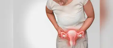 Prevención de cáncer de cuello uterino ¿Cómo podemos prevenir el cáncer de cuello uterino?