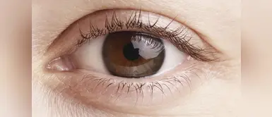 ¿Cómo detectar las cataratas? ¿Cuáles son los síntomas de las cataratas oculares?