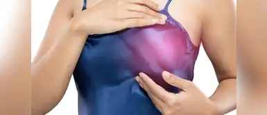 El cáncer de mama no siempre viene acompañado por un bulto en el seno ¿El cáncer de mama viene siempre acompañado por un bulto en el seno?