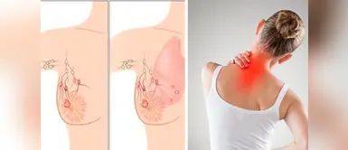 El cáncer de mama podría tener como consecuencia cáncer de columna ¿El cáncer de columna puede ser consecuencia del cáncer de mama?