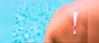 La constante exposición de la piel a los rayos solares puede producir enfermedades. ¿Cuáles son las enfermedades más comunes que se produce durante el verano?