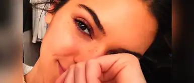 ¿Tienes pecas? Estos son los tratamientos que te recomendamos ¿Tienes pecas? Estos son los tratamientos que te recomendamos