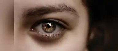 ¿Sabías que el cáncer de piel puede empezar en el ojo? ¿Sabías que el cáncer de piel puede empezar en el ojo?