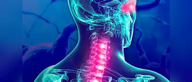 Más del 20% de peruanos con esclerosis múltiple reciben mal diagnóstico Más del 20% de peruanos con esclerosis múltiple reciben mal diagnóstico