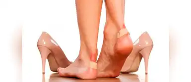 Olvídate de las ampollas con estos increíbles remedios caseros Olvídate de las ampollas con estos increíbles remedios caseros