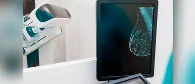 Conoce la increíble máquina que detectará rápidamente el cáncer de mama Conoce la increíble máquina que detectará rápidamente el cáncer de mama