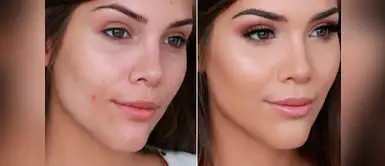 Esta es la manera correcta de cubrir granitos con maquillaje Esta es la manera correcta de cubrir granitos con maquillaje