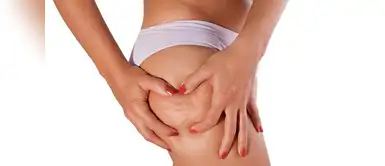 Elimina la celulitis con estos 5 ejercicios. ¡Sin mucho esfuerzo! Elimina la celulitis con estos 5 ejercicios. ¡Sin mucho esfuerzo!