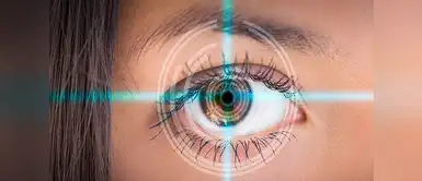 Glaucoma: un silencio mal ocular que se puede prevenir Glaucoma: un silencio mal ocular que se puede prevenir