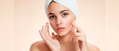 El producto que empeora los brotes de acné y probablemente estés usando El producto que empeora los brotes de acné y probablemente estés usando