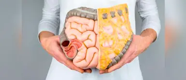 Si se detecta a tiempo el cáncer de colon y recto se puede curar Si se detecta a tiempo el cáncer de colon y recto se puede curar