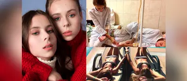 Gemelas sufren de anorexia por cumplir los estereotipos de la moda Gemelas sufren de anorexia por cumplir los estereotipos de la moda
