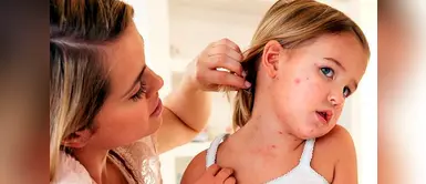 ¿Cómo diferenciar la varicela del sarampión? ¿Cómo diferenciar la varicela del sarampión?