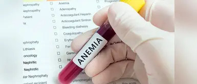 Anemia: 5 alimentos ricos en hierro para combatir esta afección Anemia: 5 alimentos ricos en hierro para combatir esta afección