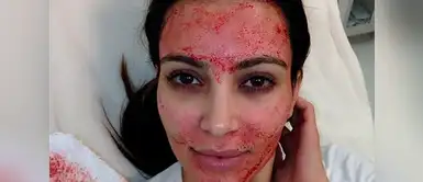 Dos personas contraen VIH al realizarse el famoso "facial vampiro" Dos personas contraen VIH al realizarse el famoso "facial vampiro"