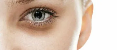 Aprende a preparar parches caseros para ayudar a eliminar las ojeras Aprende a preparar parches caseros para ayudar a eliminar las ojeras