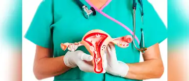 Cáncer de cuello uterino: 5 señales que te alertan sobre este mal Cáncer de cuello uterino: 5 señales que te alertan sobre este mal