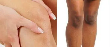 Descubre estos tips que te ayudarán a aclarar tus rodillas Descubre estos tips que te ayudarán a aclarar tus rodillas