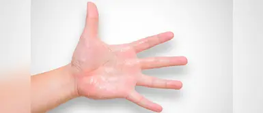 La sudoración en las manos puede ser provocados por el estrés y otros factores La sudoración en las manos puede ser provocados por el estrés y otros factores