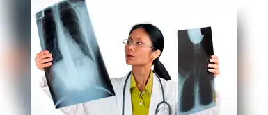 Neumonitis por hipersensibilidad: qué es, síntomas y todo lo que necesitas saber Neumonitis por hipersensibilidad: qué es, síntomas y todo lo que necesitas saber