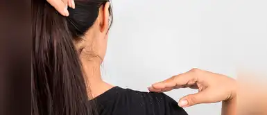 ¿Tienes caspa seca? 3 remedios caseros para combatir el hongo en la cabeza ¿Tienes caspa seca? 3 remedios caseros para combatir el hongo en la cabeza