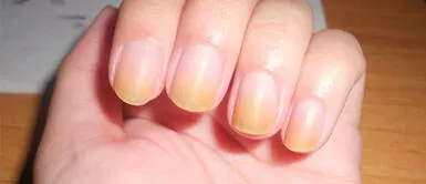 Así es como puedes quitar el amarillo de tus uñas producido por el esmalte Así es como puedes quitar el amarillo de tus uñas producido por el esmalte