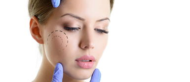 ¿Bichectomía? Descubre cuáles son las consecuencias de esta cirugía estética ¿Bichectomía? Descubre cuáles son las consecuencias de esta cirugía estética