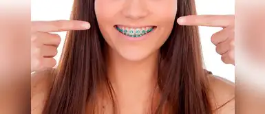 ¿Tienes brackets? Conoce los beneficios que brinda la ortodoncia ¿Tienes brackets? Conoce los beneficios que brinda la ortodoncia