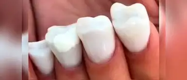 ¿Uñas con forma de dientes? Conoce esta nueva tendencia de manicure de Rusia ¿Uñas con forma de dientes? Conoce esta nueva tendencia de manicure de Rusia