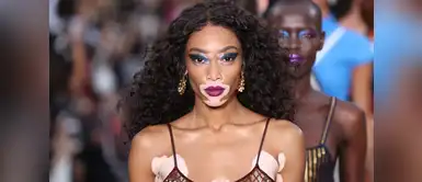 Winnie Harlow: modelo con vitíligo festeja su primera portada de Vogue Winnie Harlow: modelo con vitíligo festeja su primera portada de Vogue