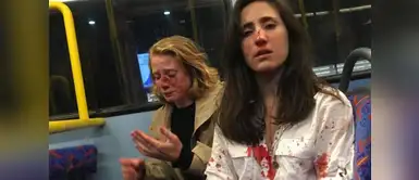 Mujeres sufren brutal ataque homófobo en un autobus en Londres Mujeres sufren brutal ataque homófobo en un autobus en Londres