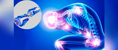 Síndrome de Guillain Barré: ¿de dónde viene el nombre de esta enfermedad? Síndrome de Guillain Barré: ¿de dónde viene el nombre de esta enfermedad?