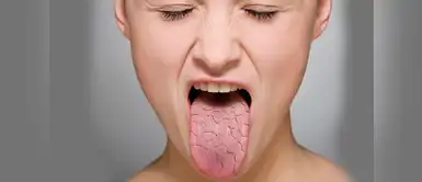 ¿La deshidratación puede provocar temblores corporales? ¿La deshidratación puede provocar temblores corporales?