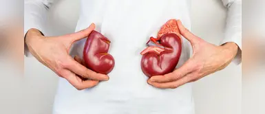 Piedras en los riñones: conoce cuáles son las causas y cómo prevenirlas Piedras en los riñones: conoce cuáles son las causas y cómo prevenirlas