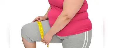 Sobrepeso y obesidad: conoce más sobre la cirugía como alternativa Sobrepeso y obesidad: conoce más sobre la cirugía como alternativa