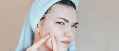 ¿Quieres deshacerte de las espinillas? Con estos remedios podrás lograrlo ¿Quieres deshacerte de las espinillas? Con estos remedios podrás lograrlo