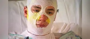 Incendio: joven termina quemado por salvar a su sobrina de 8 años Incendio: joven termina quemado por salvar a su sobrina de 8 años