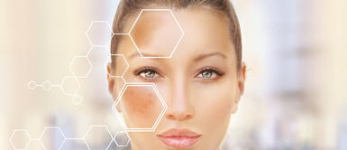 ¿Manchas en la piel? 3 productos para combatir la hiperpigmentación ¿Manchas en la piel? 3 productos para combatir la hiperpigmentación