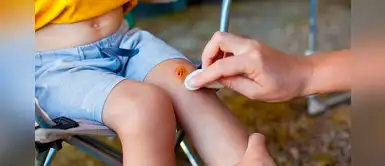 6 pasos que debes seguir para curar una herida infectada 6 pasos que debes seguir para curar una herida infectada