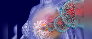 Cáncer de mama: desarrollan proyecto para detección temprana de la enfermedad Cáncer de mama: desarrollan proyecto para detección temprana de la enfermedad