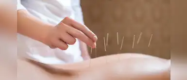 ¿La acupuntura ayuda a tratar la angina de pecho? ¿La acupuntura ayuda a tratar la angina de pecho?