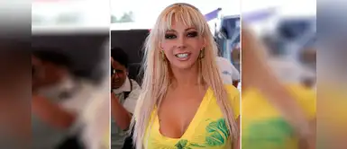 Peritonitis, la inflamación que causó la muerte de Vicky Palacios Peritonitis, la inflamación que causó la muerte de Vicky Palacios