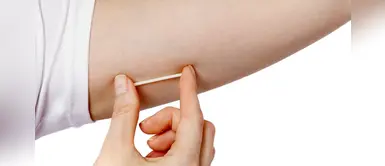 Le colocaron implante anticonceptivo en el brazo y se le va al pulmón Le colocaron implante anticonceptivo en el brazo y se le va al pulmón