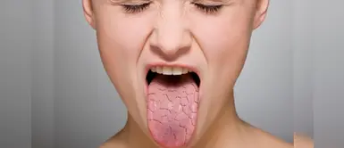 ¿Tienes la boca seca? 4 poderosos remedios caseros para ayudar a solucionarlo ¿Tienes la boca seca? 4 poderosos remedios caseros para ayudar a solucionarlo