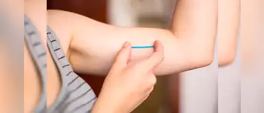 Los pros y contras del uso del implante anticonceptivo Los pros y contras del uso del implante anticonceptivo