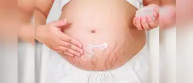 ¿Rascarse la barriga en el embarazo produce estrías? ¿Rascarse la barriga en el embarazo produce estrías?
